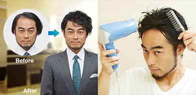 スヴェンソン増毛無料体験