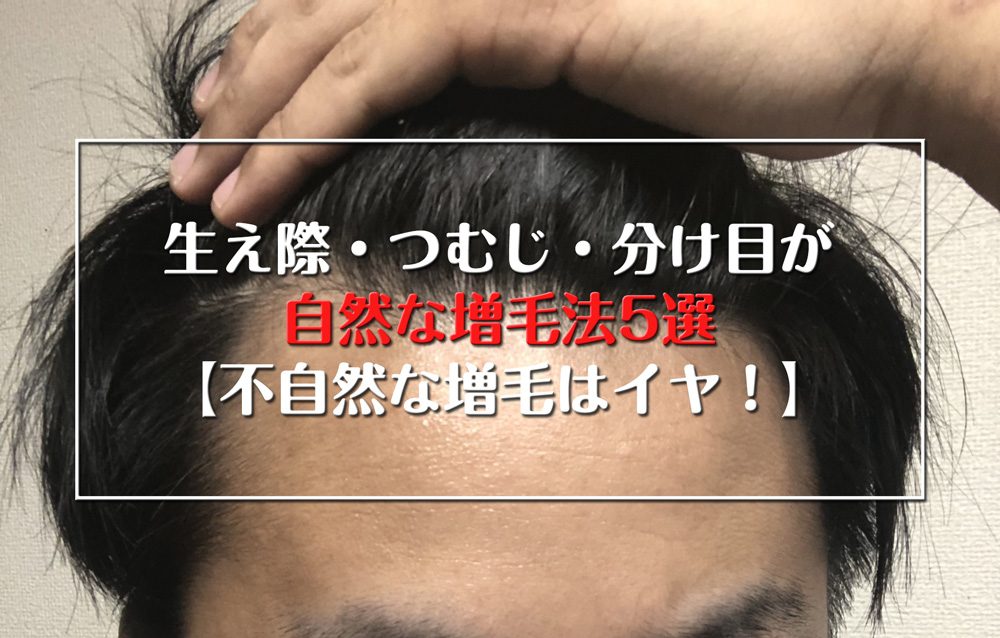 生え際・つむじ・分け目が自然な増毛法5選【不自然な増毛はイヤ！】