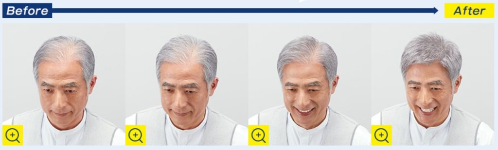 マープリアル