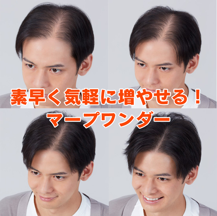 マープワンダー